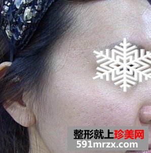 做了三维净肤效果很好，还有前后对比效果图片分享给大家！