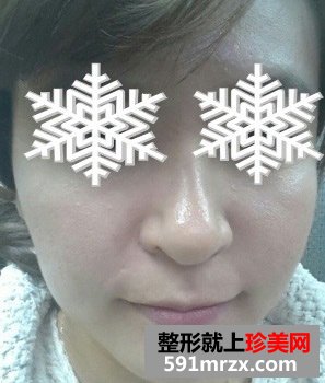 做了三维净肤效果很好，还有前后对比效果图片分享给大家！