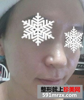 做了三维净肤效果很好，还有前后对比效果图片分享给大家！
