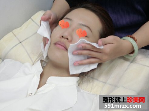 打玻尿酸后 苹果肌饱满鼻子也变翘了！