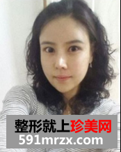 眼鼻综合+下颌角整形对比照片