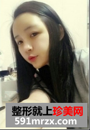 面部脂肪填充网友真实经历