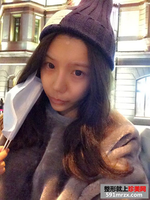 上海华美脂肪填充