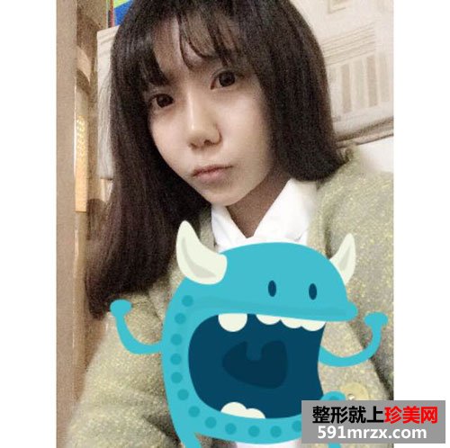 上海华美脂肪填充