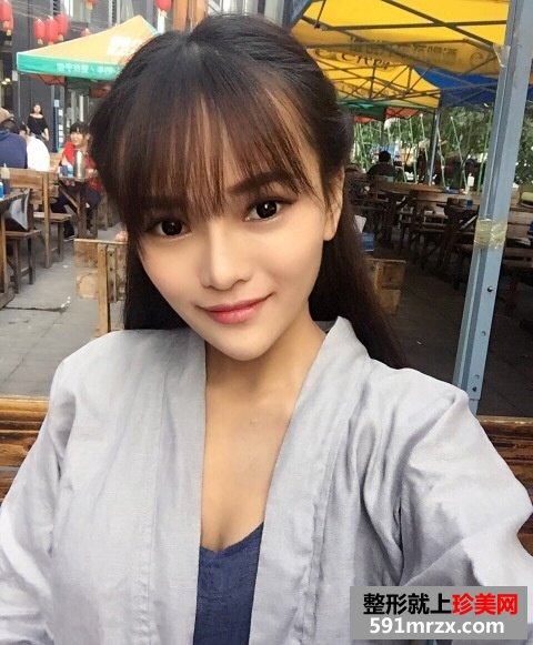 美国曼托假体隆胸手术前后对比效果照片和恢复过程