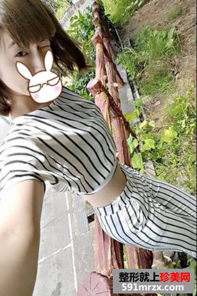 大腿吸脂术后让我重新拥有纤细美丽的双腿