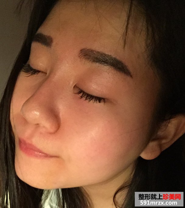 韩式半永久纹眉毛的成功案例，有前后对比效果图片和恢复过程照片哦！