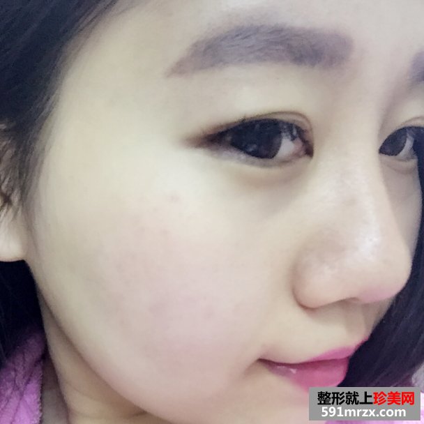 韩式半永久纹眉毛的成功案例，有前后对比效果图片和恢复过程照片哦！