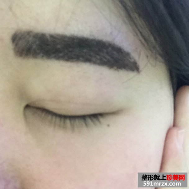 韩式半永久纹眉毛的成功案例，有前后对比效果图片和恢复过程照片哦！