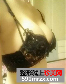 北京八大处假体隆胸恢复过程分享