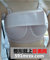 北京知音假体隆胸前后对比照