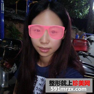 打瘦脸针三个月了 脸小了一大圈