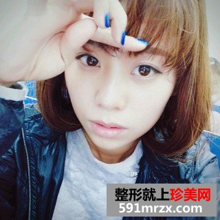 打瘦脸针三个月了 脸小了一大圈