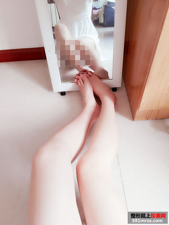 真实瘦小腿案例