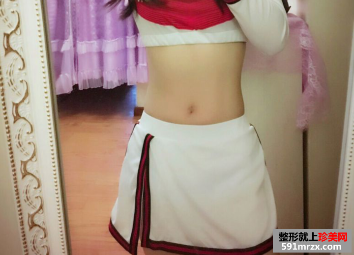 水动力吸脂减肥真实案例对比图