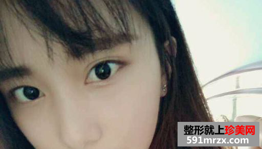 超美鼻综合真实案例对比图