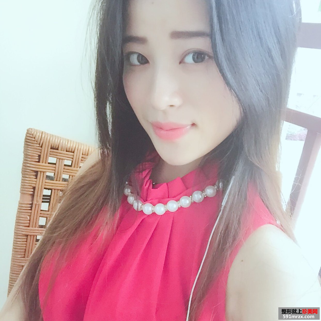 美铝注射瑞蓝玻尿酸丰唇手术前后对比效果图片恢复过程分享