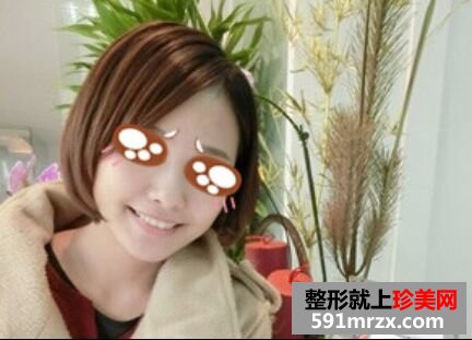 瘦脸针+玻尿酸隆案例效果图分享