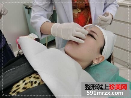 给大家看看我玻尿酸隆鼻+垫下巴的效果