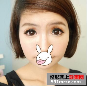 熬过哺乳期去注射瘦脸+去抬头纹