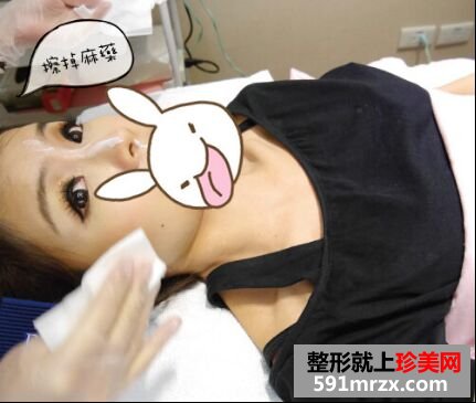 熬过哺乳期去注射瘦脸+去抬头纹