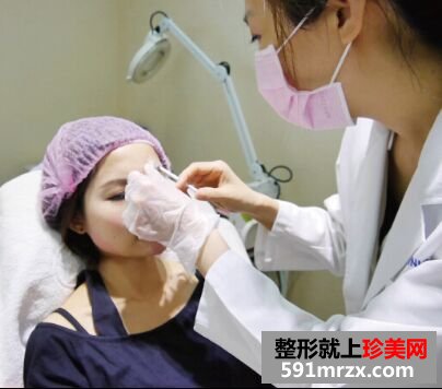 熬过哺乳期去注射瘦脸+去抬头纹