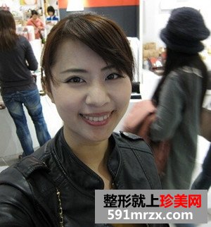 打瘦脸针实现了拥有鹅蛋脸的愿望