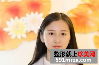 九院割双眼皮真实案例对比图