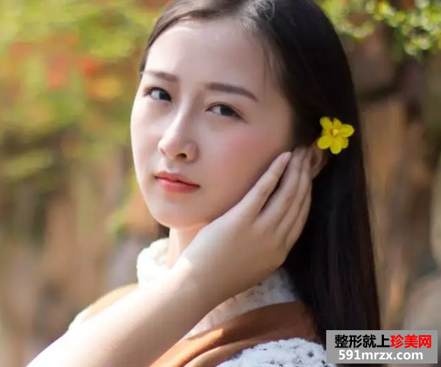 九院割双眼皮真实案例对比图