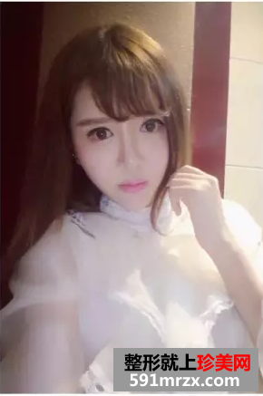 冯斌自体脂肪面部填充真人案例对比图