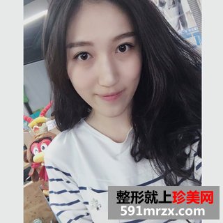 芭比双眼皮前后效果对比