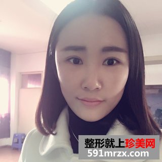 脂肪填充多久恢复自然 上海时光自体脂肪填充案例