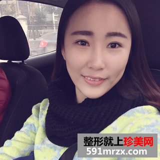 脂肪填充多久恢复自然 上海时光自体脂肪填充案例
