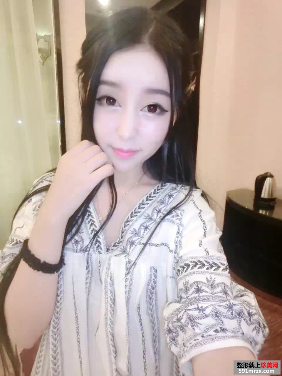 美女做玻尿酸丰苹果肌手术前后对比效果图片恢复过程分享
