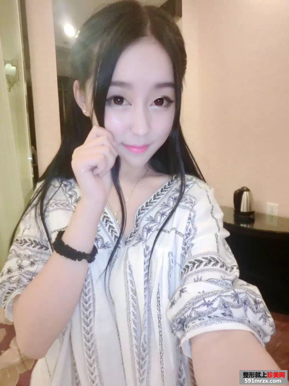 美女做玻尿酸丰苹果肌手术前后对比效果图片恢复过程分享