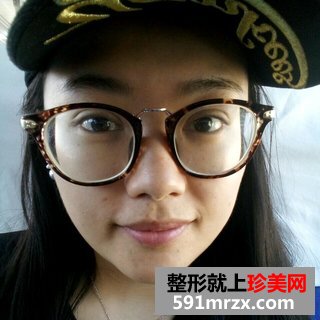 水光针效果图前后对比 北京俯大水光针注射