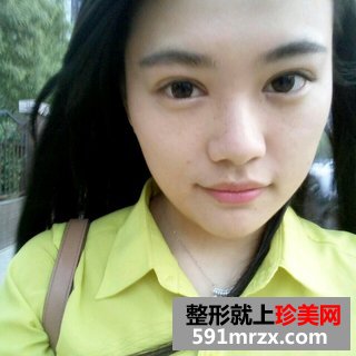 水光针效果图前后对比 北京俯大水光针注射