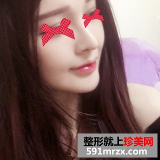 假体垫下巴恢复过程图 北京二炮假体垫下巴