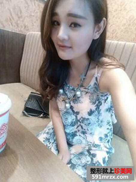 瘦脸针恢复真人案例对比图