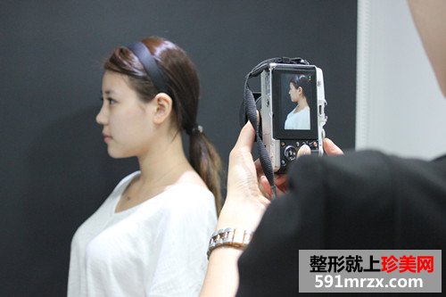 韩式超声刀+埋线面部提升恢复过程案例分享和前后对比照