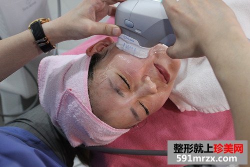 韩式超声刀+埋线面部提升恢复过程案例分享和前后对比照