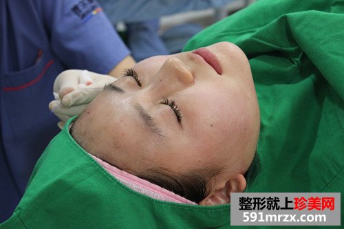 韩式超声刀+埋线面部提升恢复过程案例分享和前后对比照