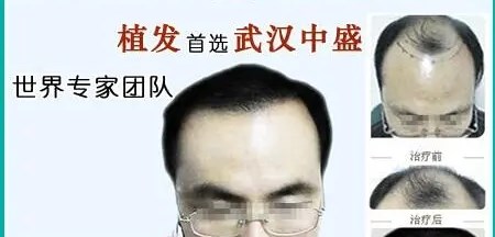 u=2817086160,451030559&fm=26&fmt=auto.webp.jpg