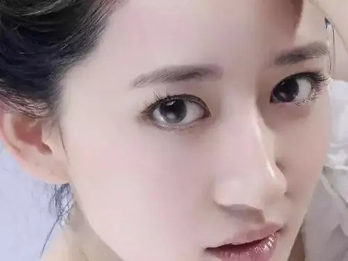 韩式双眼皮是永久的吗