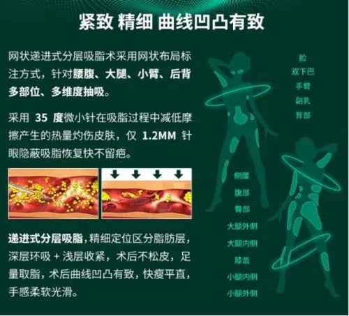 北京吸脂哪家医院好