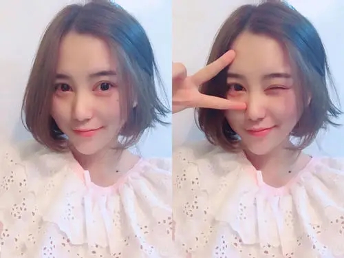 割双眼皮大概多少钱